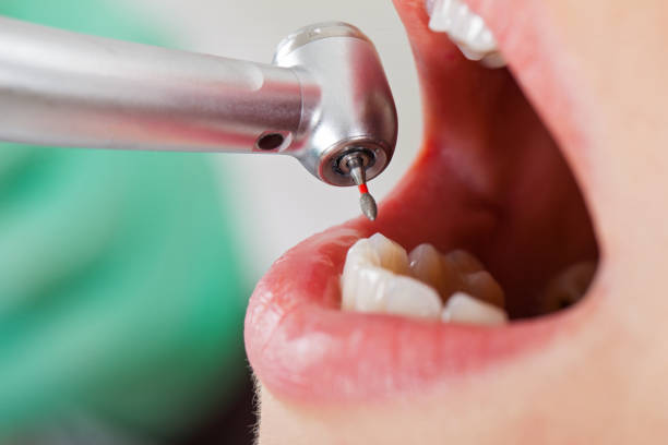 Best Emergency Treatment for Toothache in Wilmer, TX